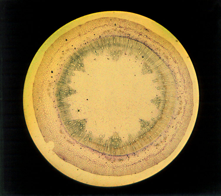 Anonymous - Microscopic Cross-section of a Plant